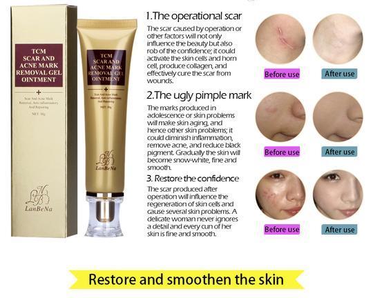 Acne Scar Removal Cream Skin Care Ginseng Extract