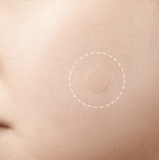 Skin Tag and Acne Patch 24pcs