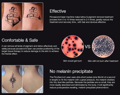 Instant Laser Dark Spot & Tattoo Remover