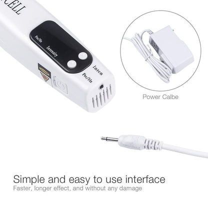 Instant Laser Dark Spot & Tattoo Remover