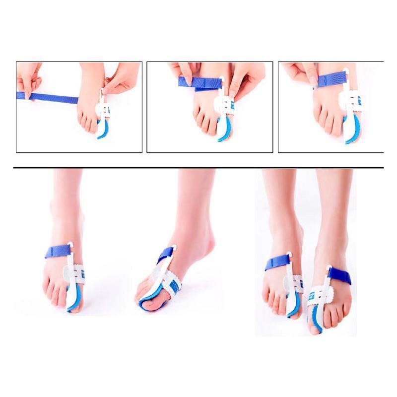 Orthopedic Bunion Corrector - Adjustable for multiple foot sizes