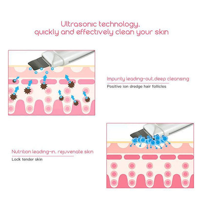 Ultrasonic Skin Scrubber Deep Face Cleaning Machine