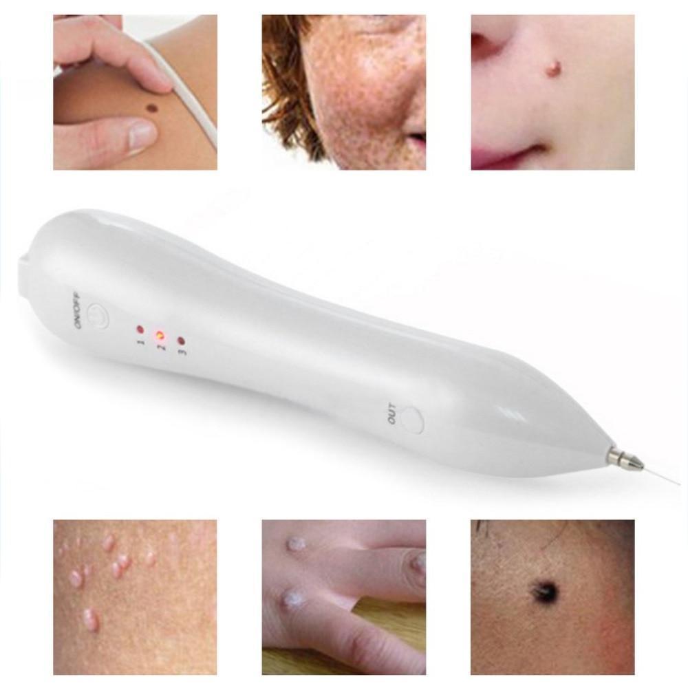 Laser Mole & Freckle Remover Warts, Age Spots, Dark Spots,