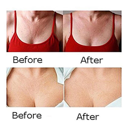 Silicone Anti Wrinkle Chest Pads