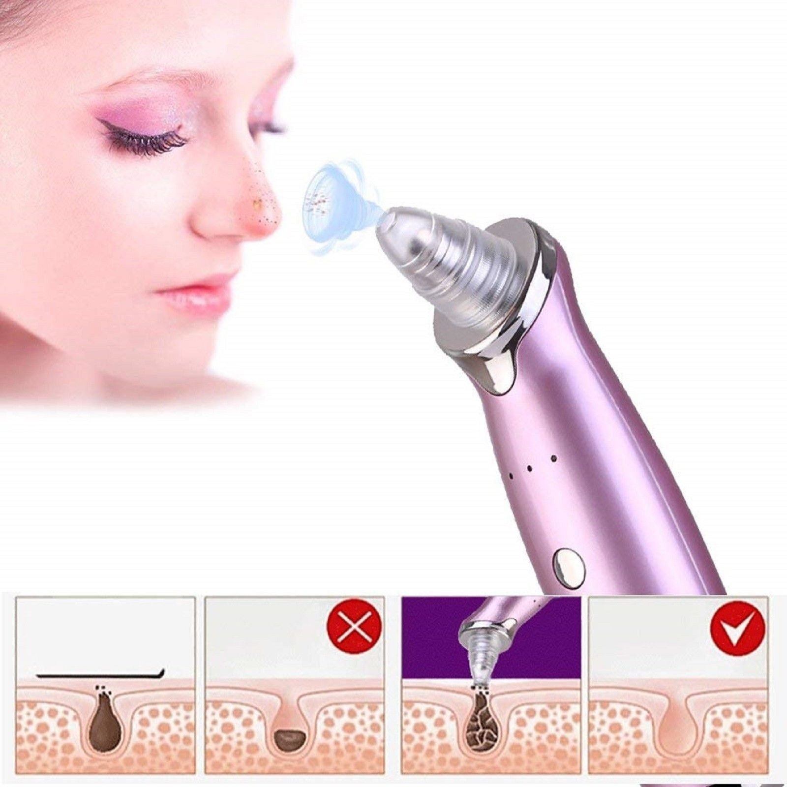 Electric Facial Pore Cleaning Tool Acne/Blackhead Remover