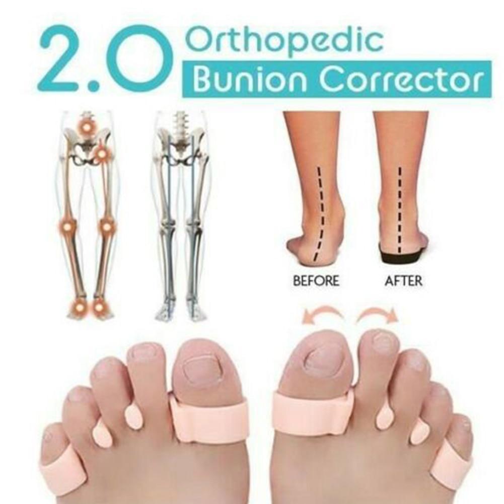 Orthopedic Bunion Corrector 2.0