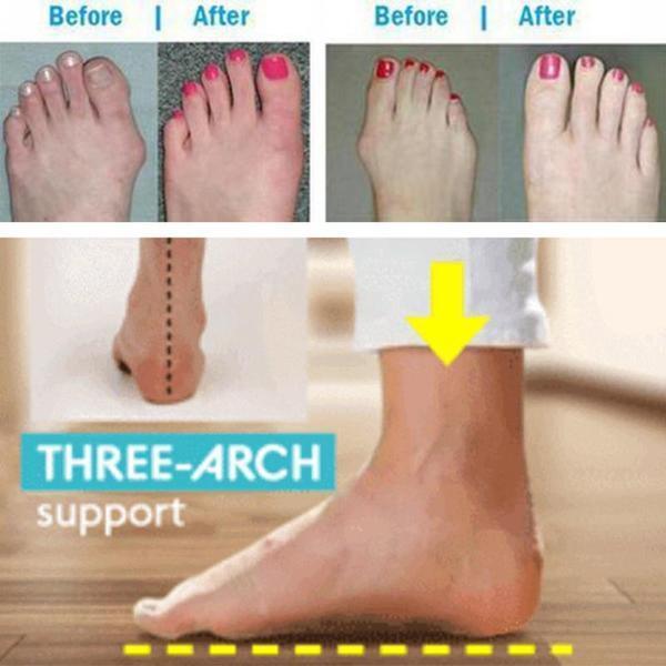 BESTWALK Orthopedic Premium Toe Corrector Sandals