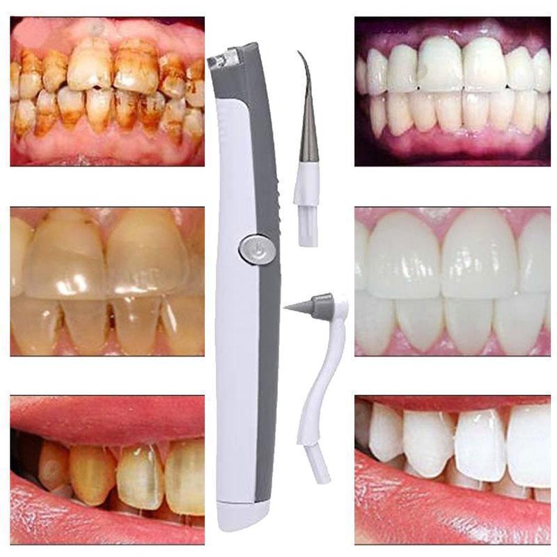 Tooth Stain Remover Whitening Tool